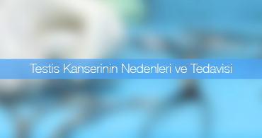 Testis Kanserinin Nedenleri ve Tedavisi